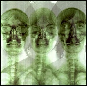 supergrass
